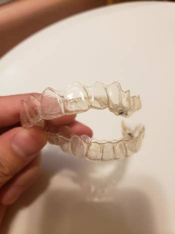 reviewer's same Invisalign looking significantly cleaner