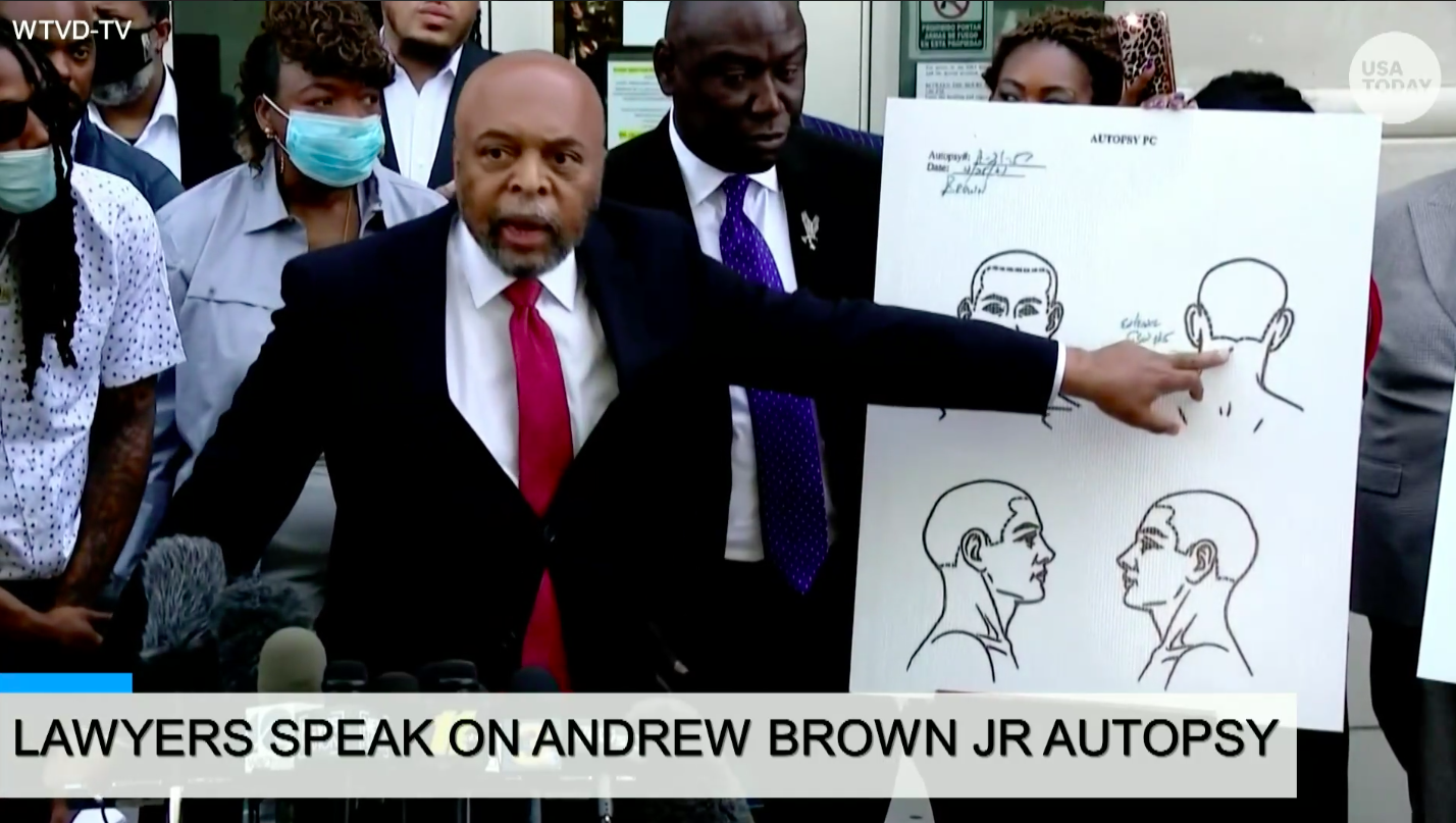 A man in a suit points to an image of a head on a large poster board during a press conference