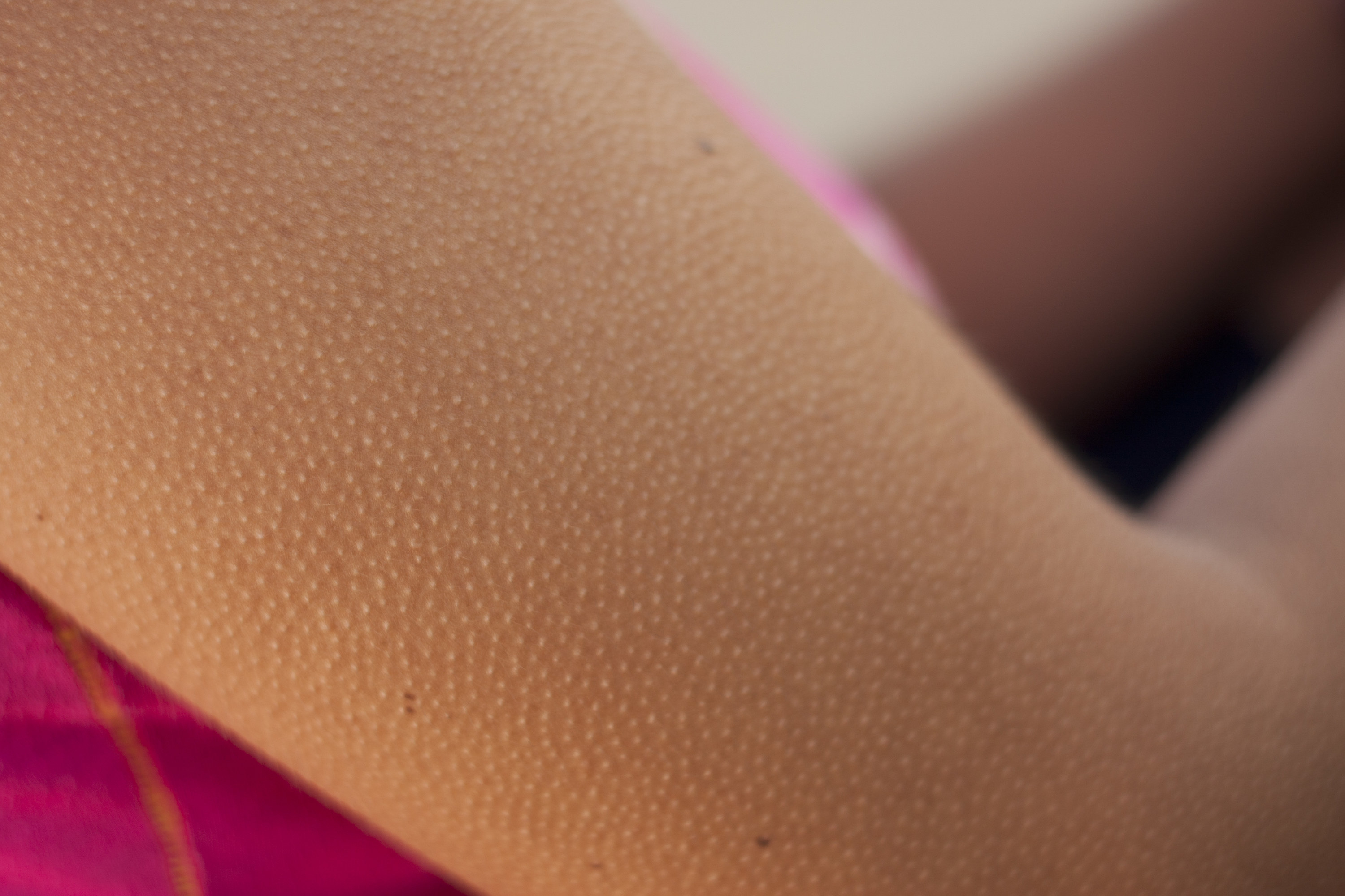 Closeup of someone&#x27;s arm as they get goosebumps