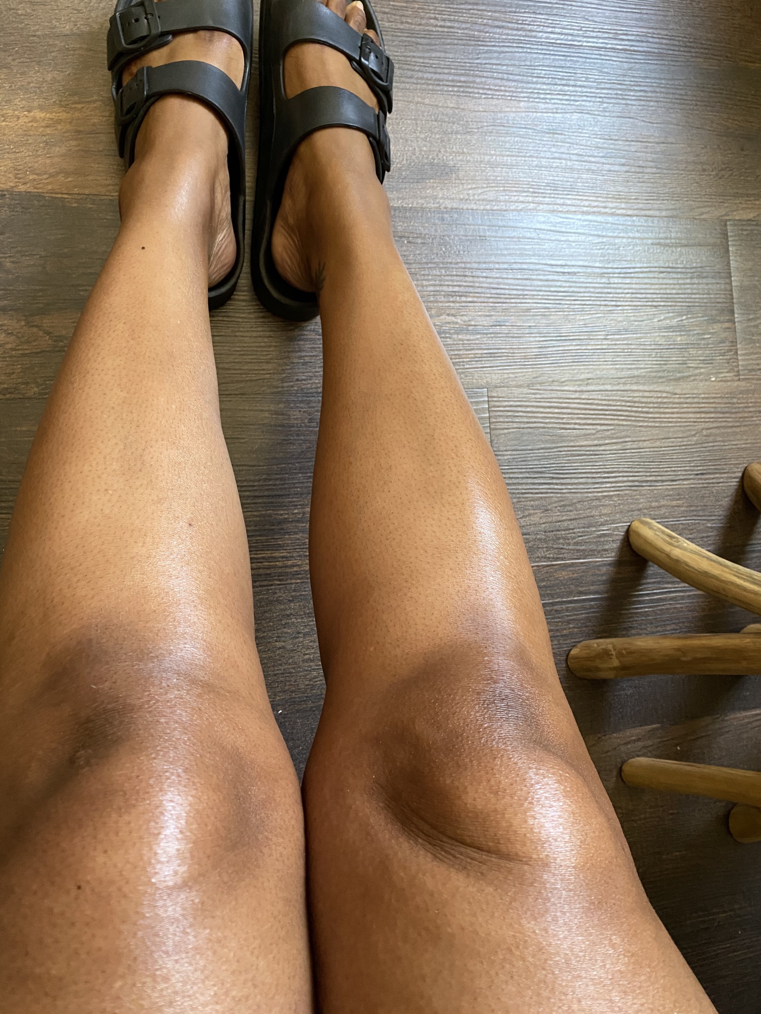 The author showing off her moisturized legs