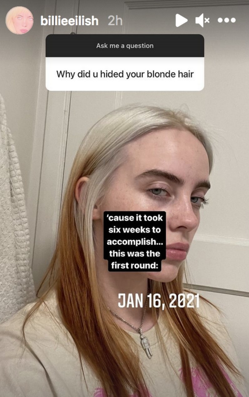 Billie Eilish Reveals Why She Hid Her Hair With A Wig