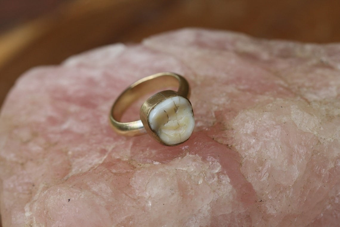simple brass ring with molar embedded 