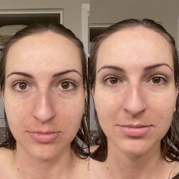 light skin reviewer with some red irritation on face in before pic, then it looking evened out after applying the tinted sunscreen