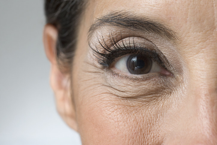 Close up of woman&#x27;s eye with wrinkles underneath