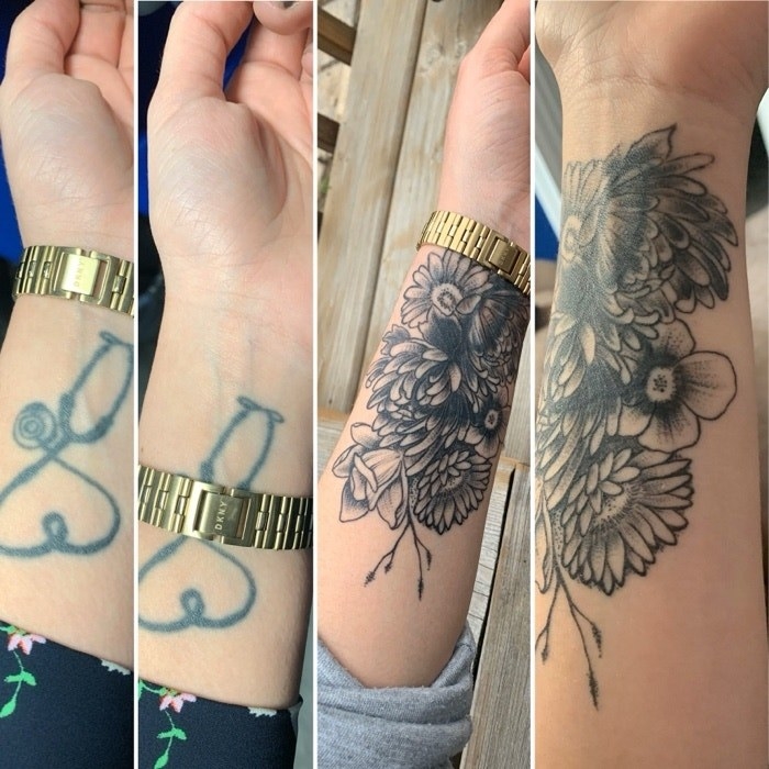 A tattoo of a stethoscope that looks like a penis when a watch is worn and cover-up of a beautiful flower