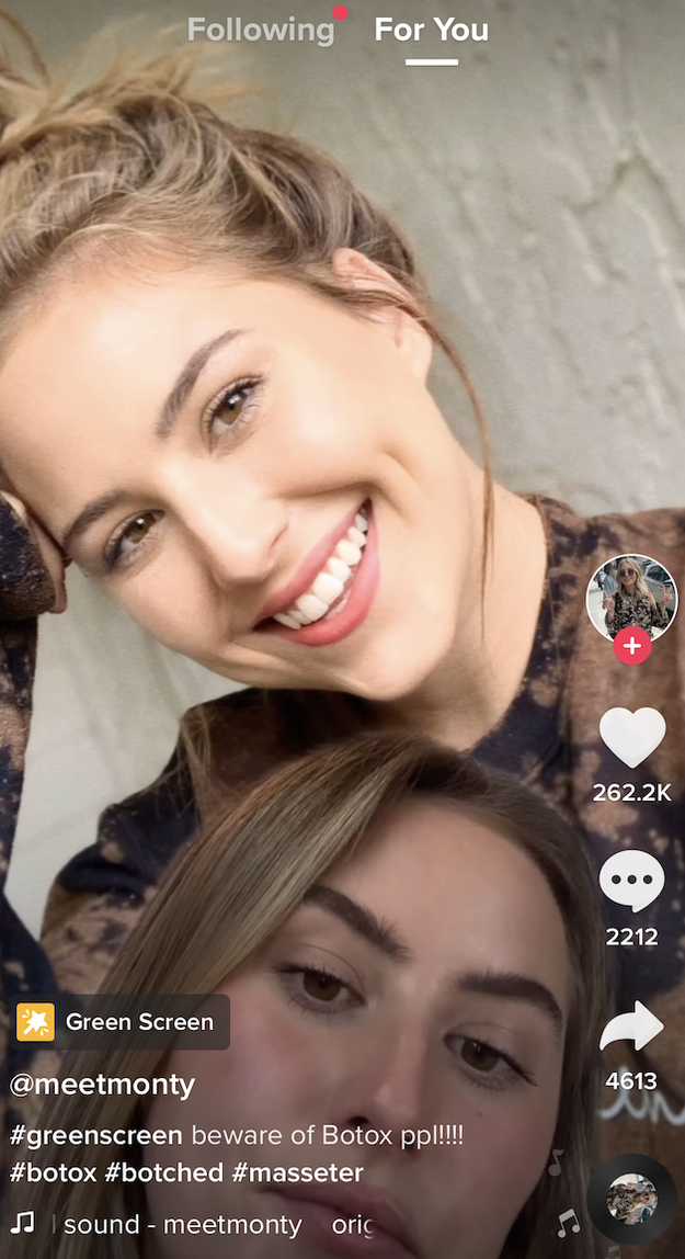 working out after botox reddit