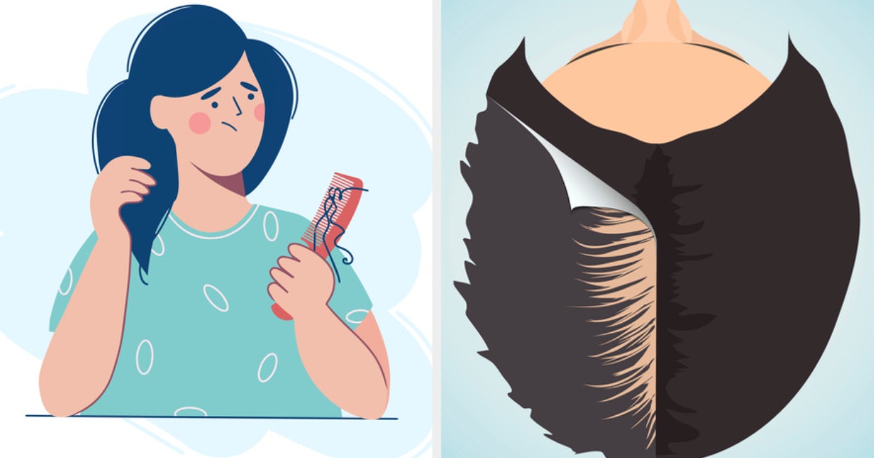 Do You Have A Hair Loss Question For A Doctor?