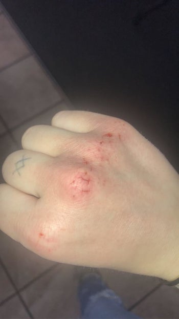 Reviewer's hand before using hand cream