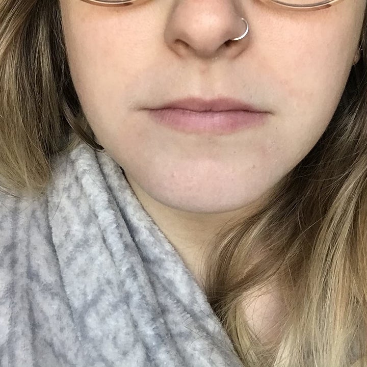 same reviewer photo with clear skin