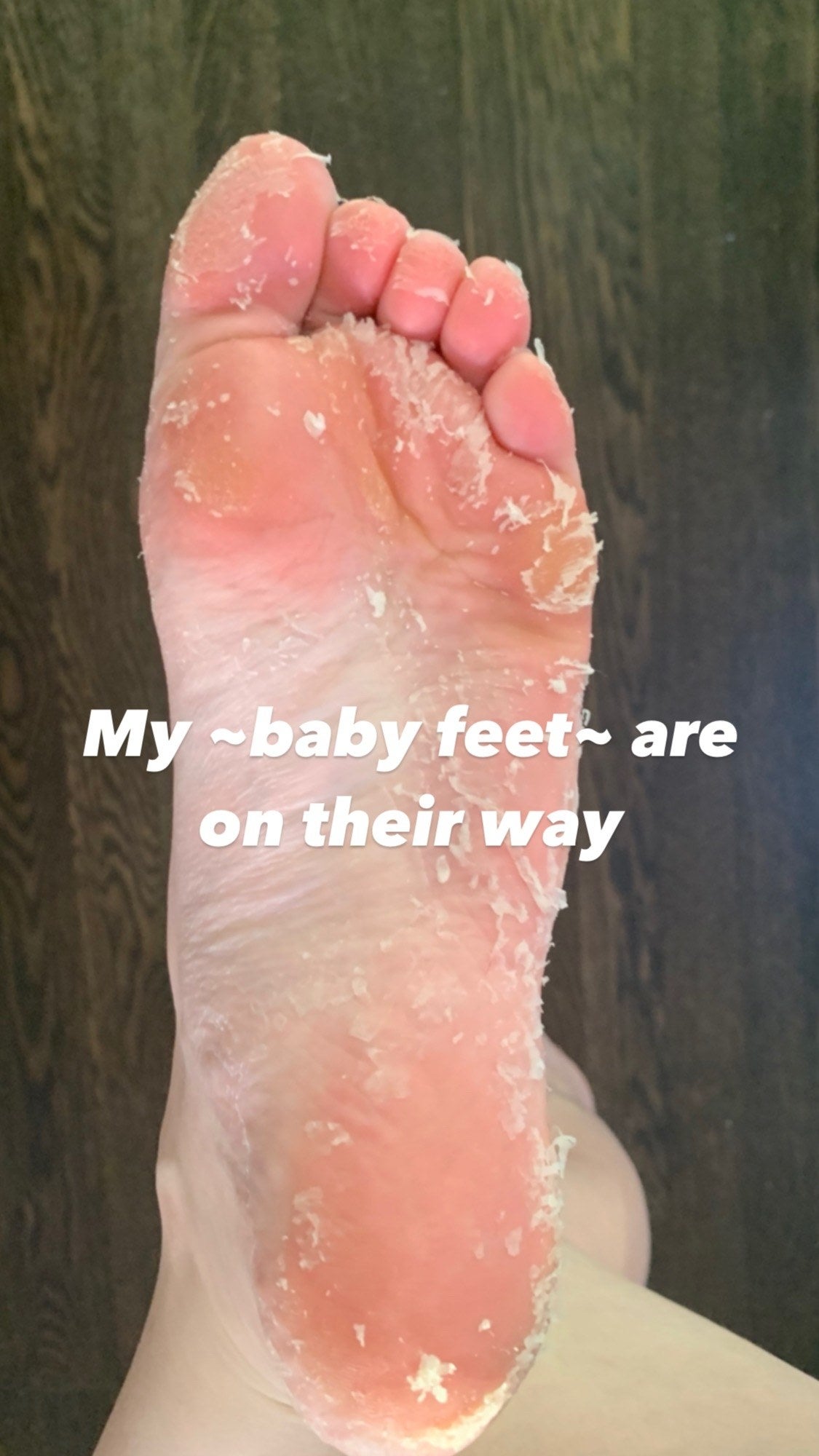 Baby Foot Review Gross Satisfying And Effective