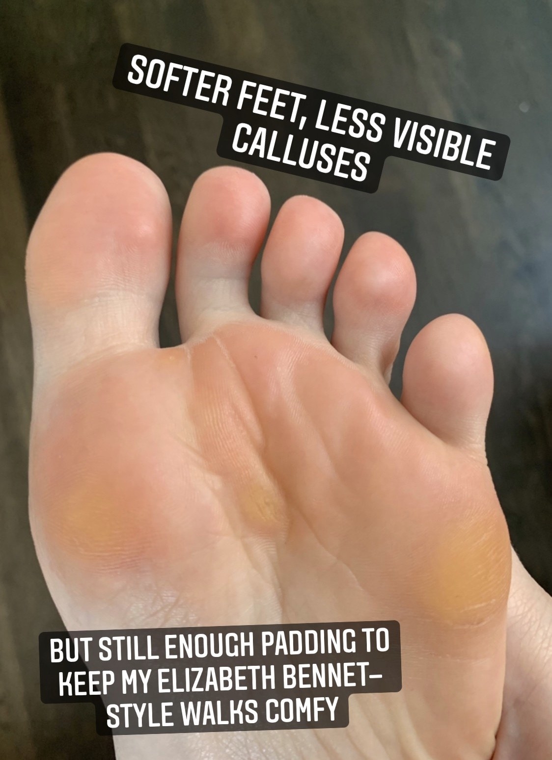 Author&#x27;s feet after baby foot with softer, less visible calluses but text &quot;still enough padding to keep my elizabeth bennet style walks comfy&quot;