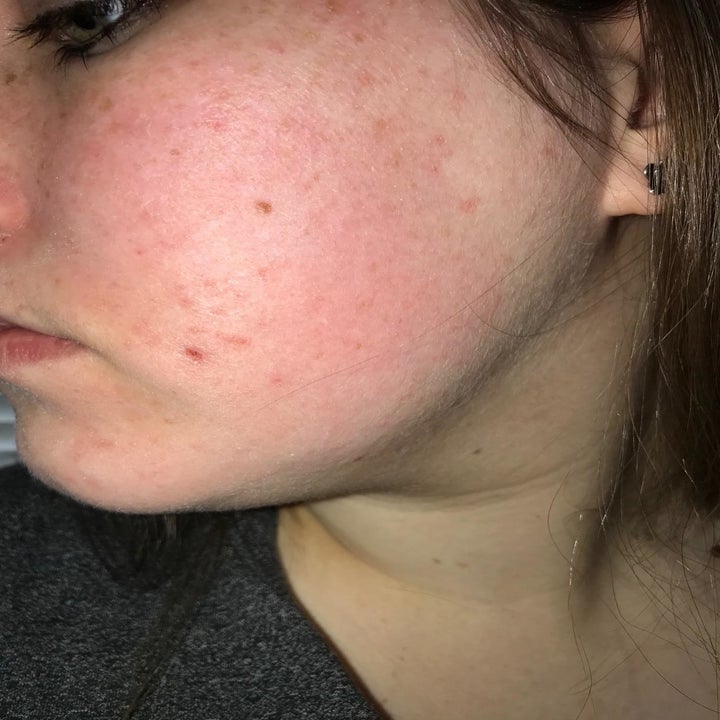 a reviewer's face before using the moisturizer