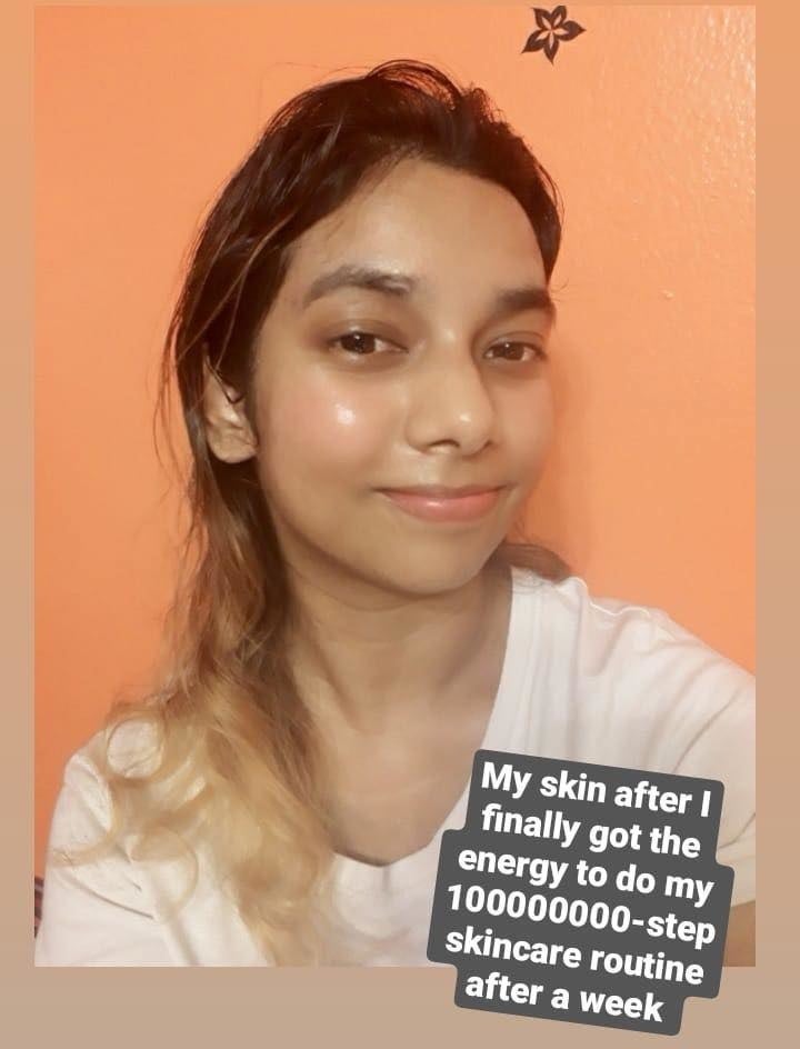 writer showing dewy hydrated skin after having gone through a 10-step korean skincare routine with text saying "my skin after I finally got energy to do 100000-step skincare routine after a week"