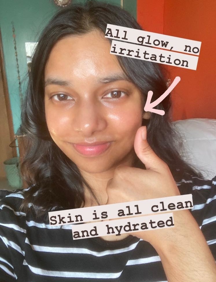 writer showing dewy hydrated skin after going through skincare routine