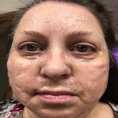 a reviewer wearing the zombie face mask