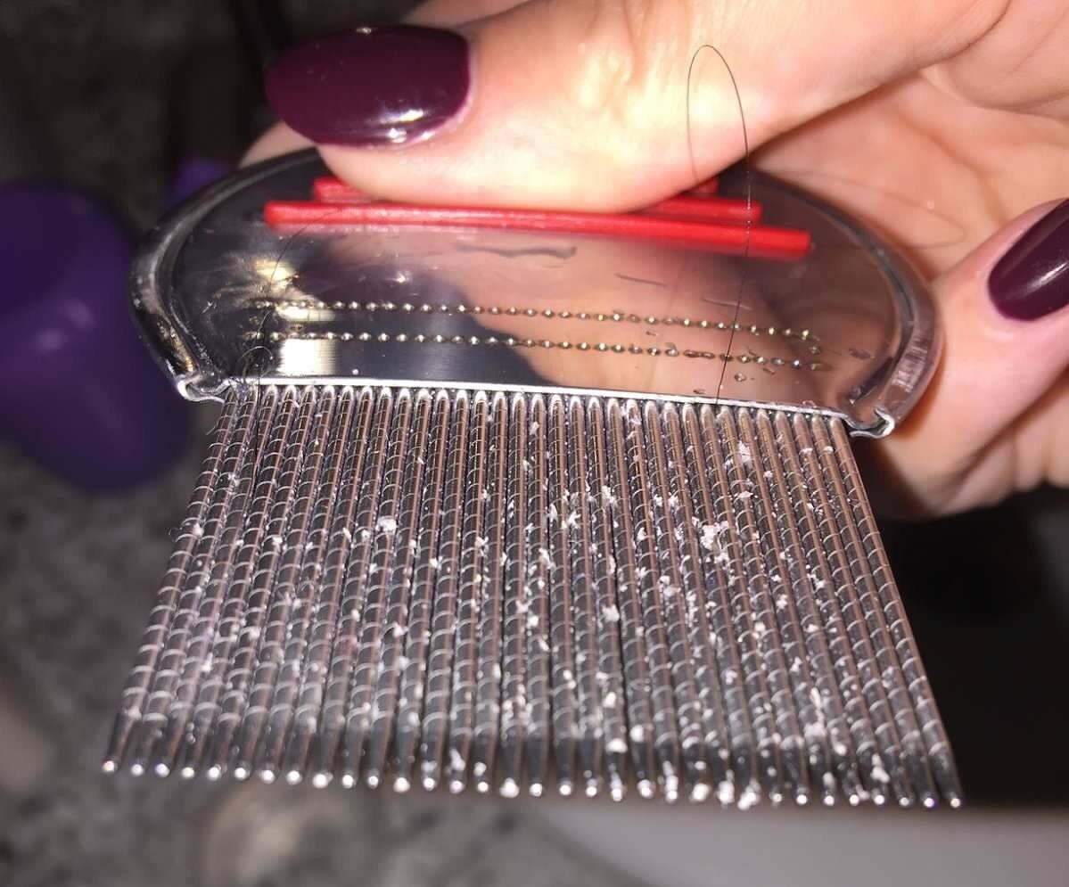 reviewer photo of a lice comb with nits on the teeth