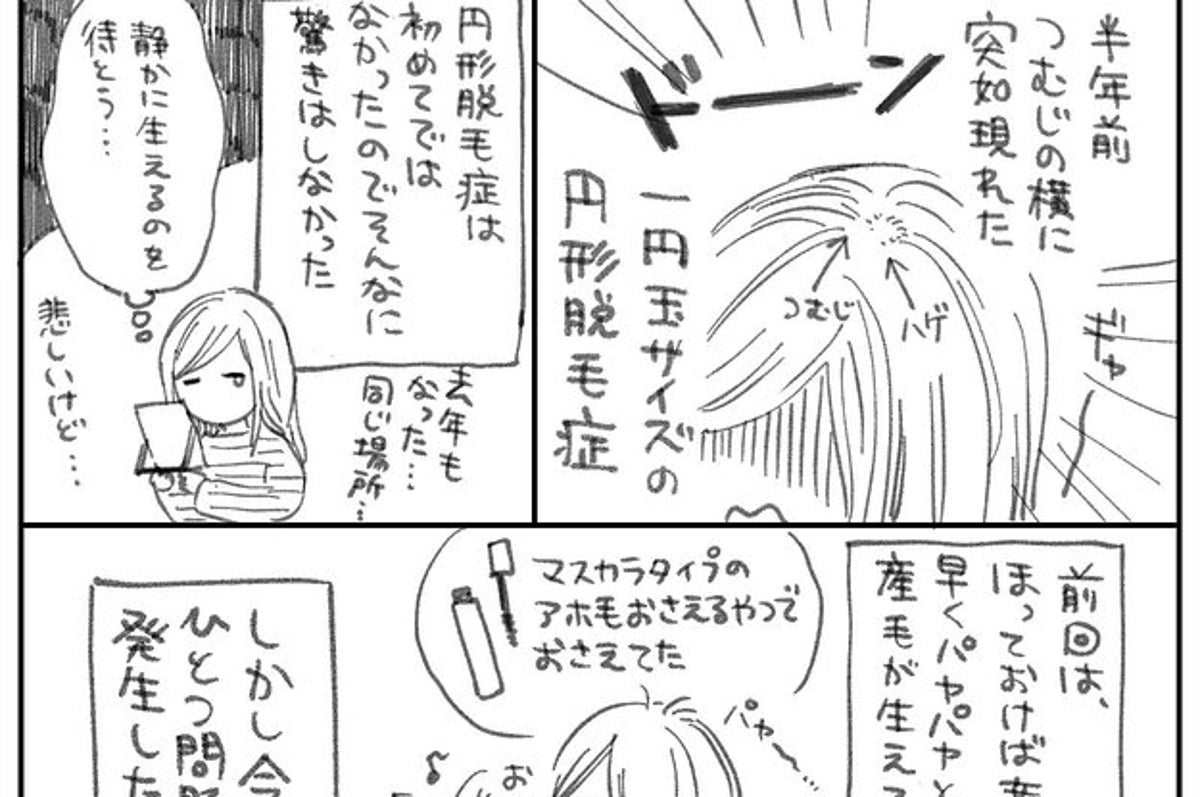 わたしも年近くこれ と反響 脱毛症と抜毛症に悩む漫画家 自分のために描いた7枚の漫画