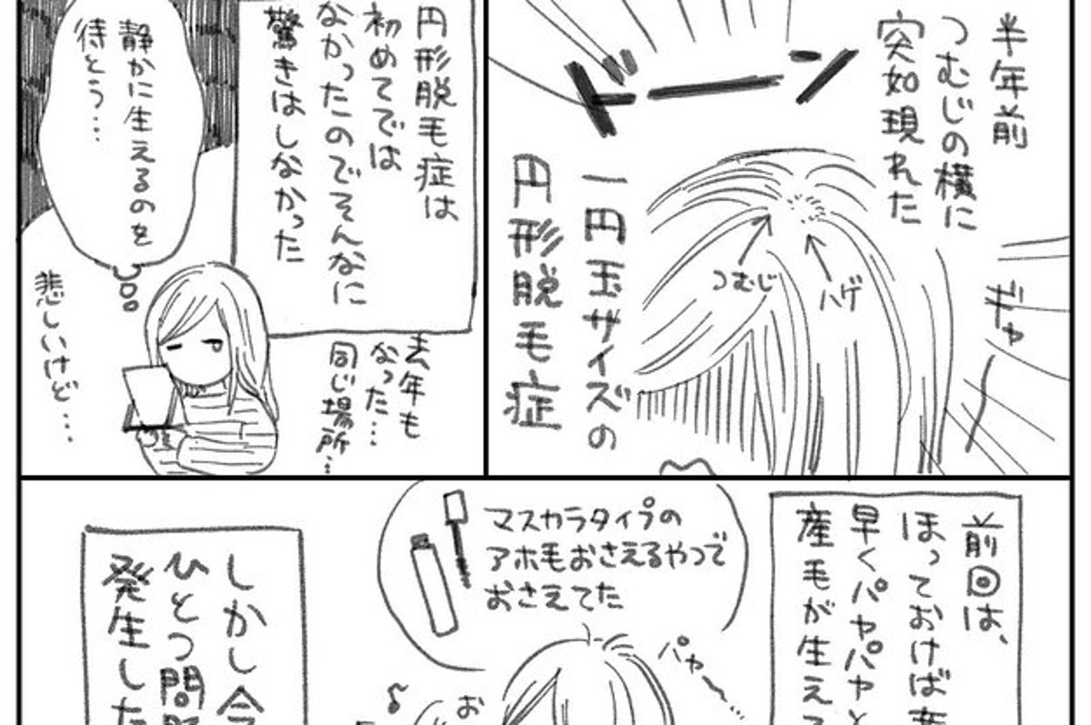 わたしも年近くこれ と反響 脱毛症と抜毛症に悩む漫画家 自分のために描いた7枚の漫画 わたしも年近くこれ と反響 脱毛症と抜毛症に悩む漫画家 自分のために描いた7枚の漫画