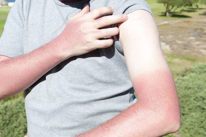 Person revealing a tan line left from their t-shirt sleeve