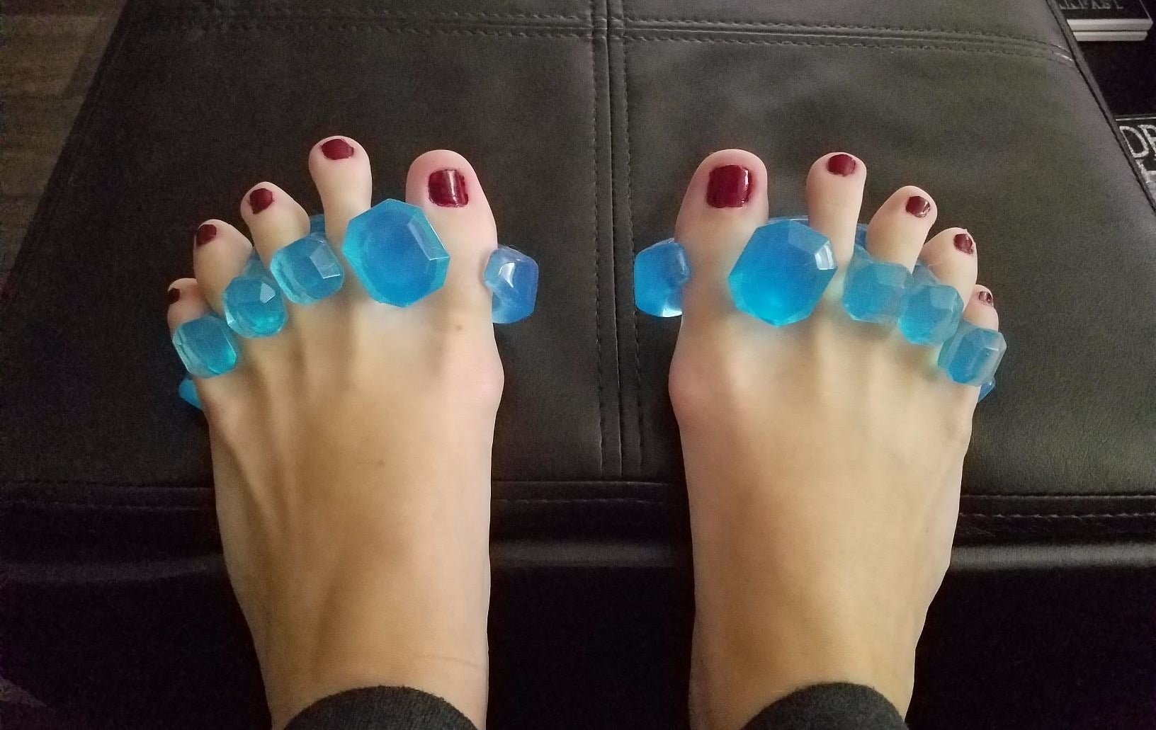 A reviewer&#x27;s feet with the separators in between their toes