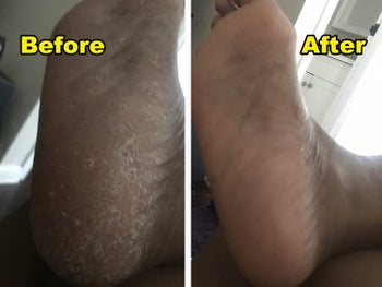 a split before and after image of a reviewers foot looking dry and cracked and the same foot looking moisturized