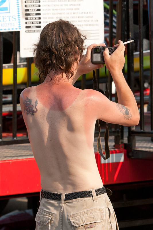 Man holding a cigarette and a camera with his sunburnt back to the camera.