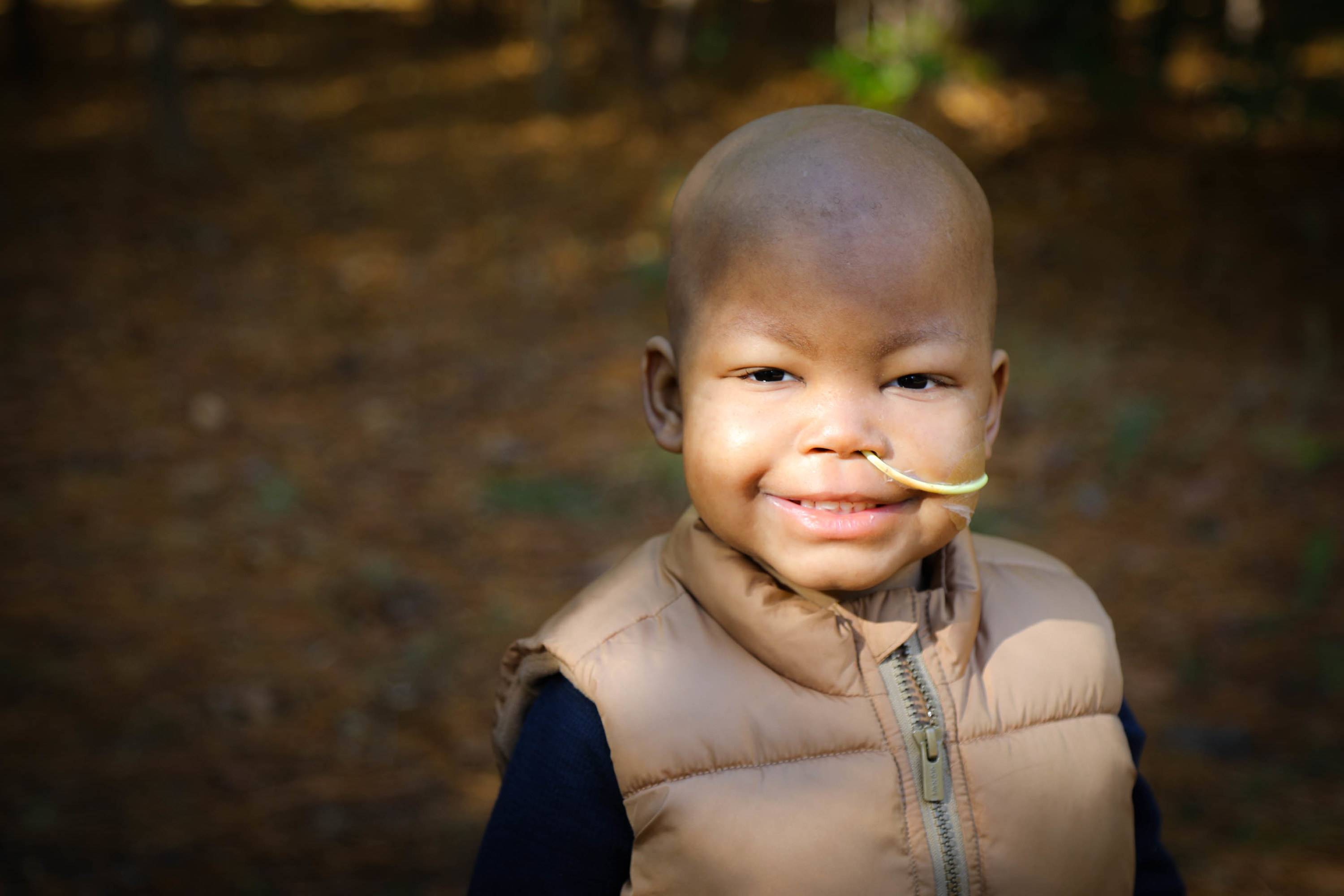 A young boy smiles with a tube in his nose
