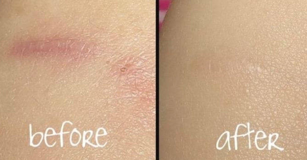 23 Skincare Products That People Say Are Worth The Money