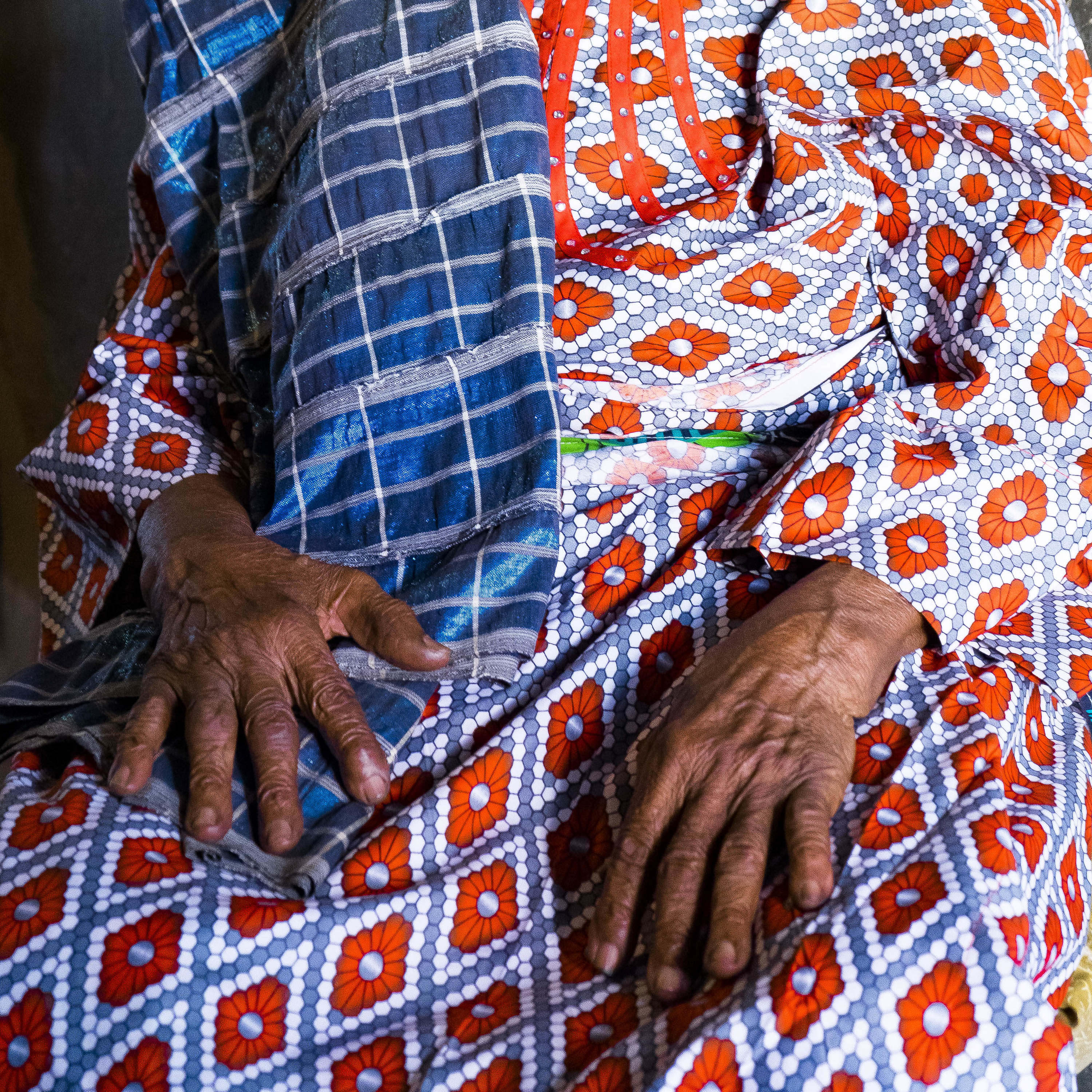 A woman rests her hands on her lap while wearing a boldly patterned dress