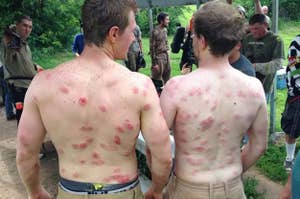 Guys have massive welts on their bare backs