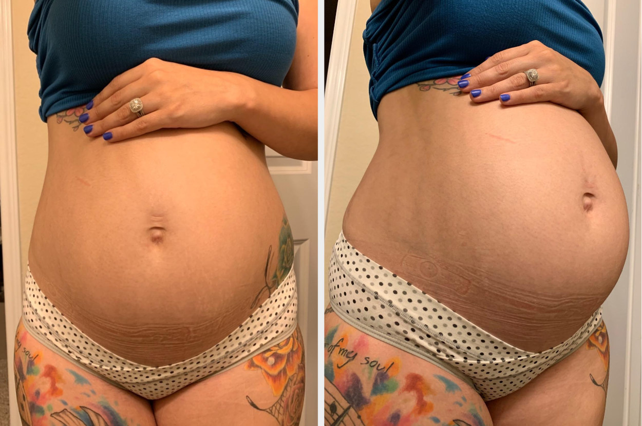 pregnant reviewer&#x27;s two photos from the front and the side of the white and black polka dot underwear sitting comfortably under their baby bump