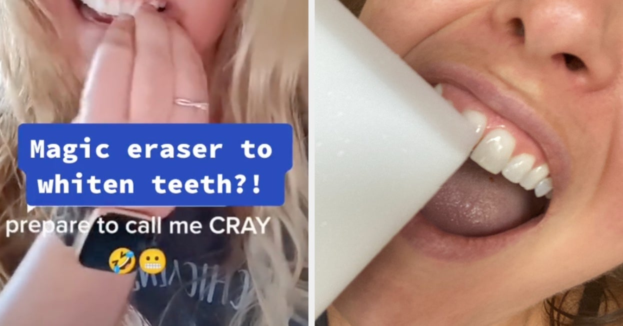 A Woman Claims Magic Erasers Are A Teeth-Whitening Secret ...
