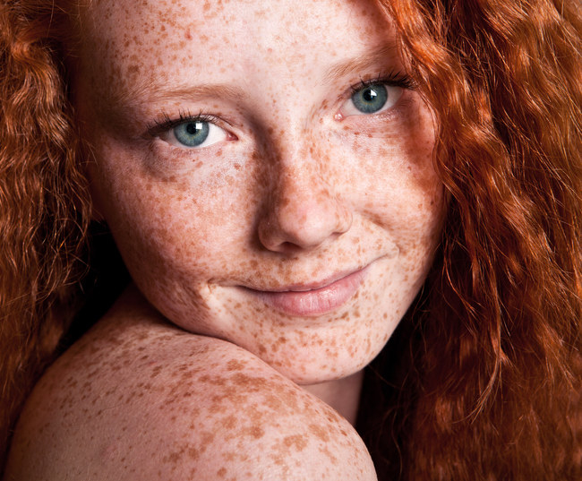Smiling person with many freckles and red hair