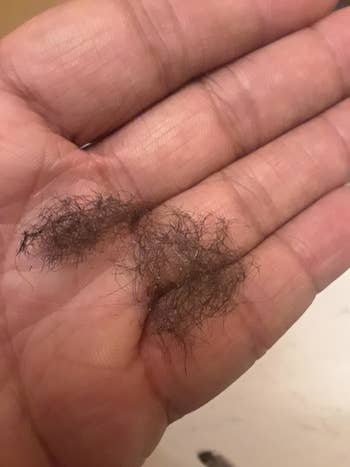 A reviewer photo of a clump of back hair in the palm of their hand