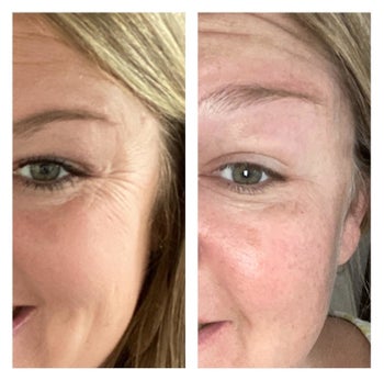 Reviewer before and after photo