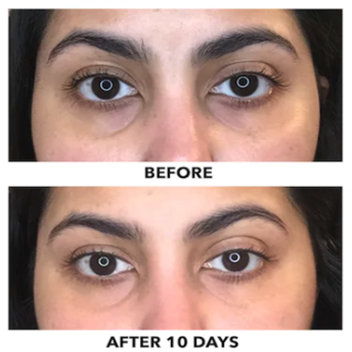 23 Best Eye Creams For Dark Circles, Wrinkles, And More