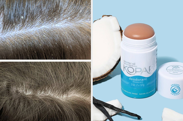a before and after of a scalp with dandruff, a stick of deodorant