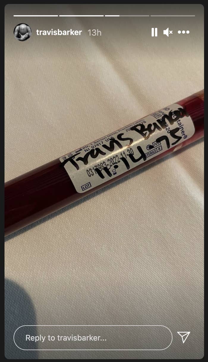 A screenshot of Travis Barker&#x27;s Instagram Story, which contains a picture of a vial of his blood