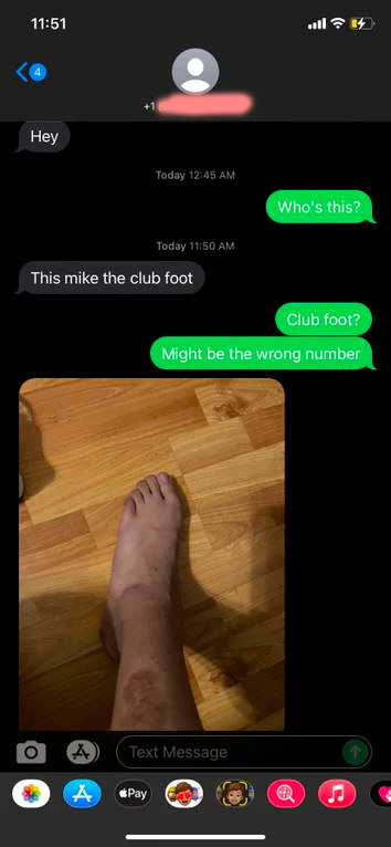 wrong number text about someone with a club foot