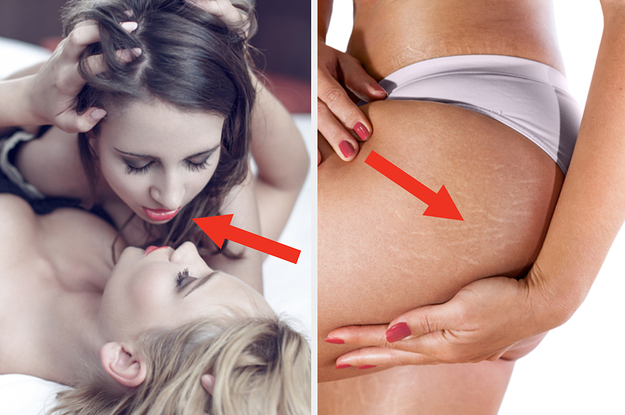 Two women about to kiss in bed, and a woman's stretchmarks