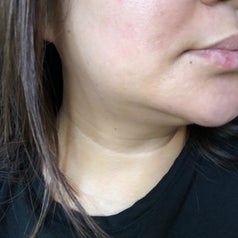 image of the same reviewer with no scars on their face