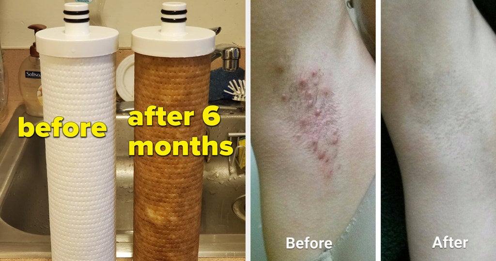 Skin How To Treat Bike Saddle Sores Body Glide Cycle Glide Anti