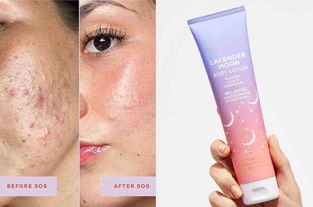 a before and after of a model using Tower28 SOS spray; a model holding a tube of lotion