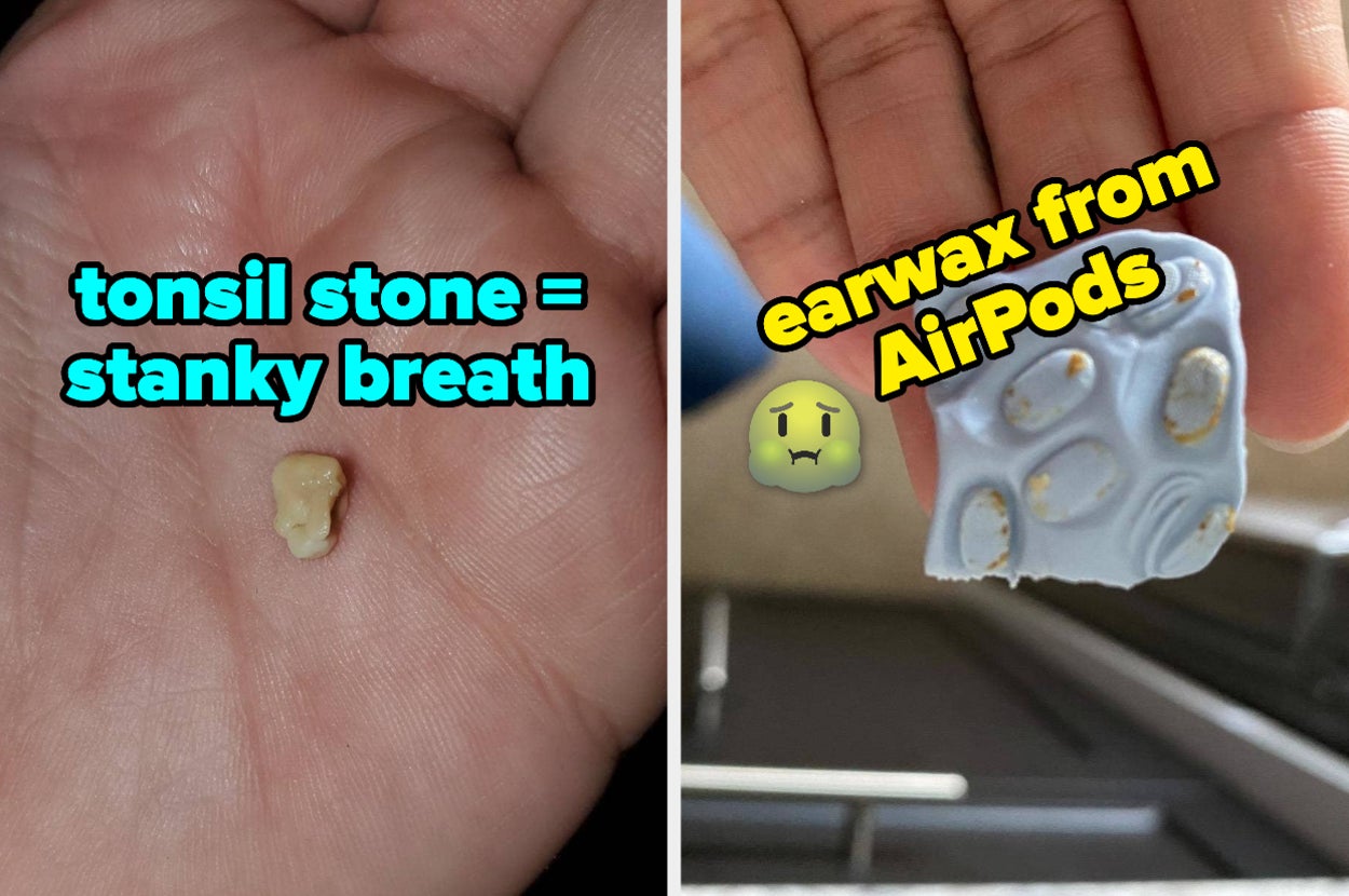 L: tonsil stone R: cleaning putty square with chunks of earwax on it that were removed from AirPods