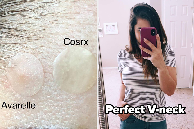 reviewer comparing avarelle and cosrx pimple patches and reviewer in a black and white striped v neck tee