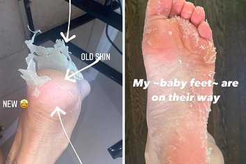 Baby Foot: Everything You've Ever Wanted to Know About the Exfoliation  Treatment for Feet