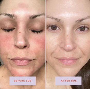 Model before and after using spray