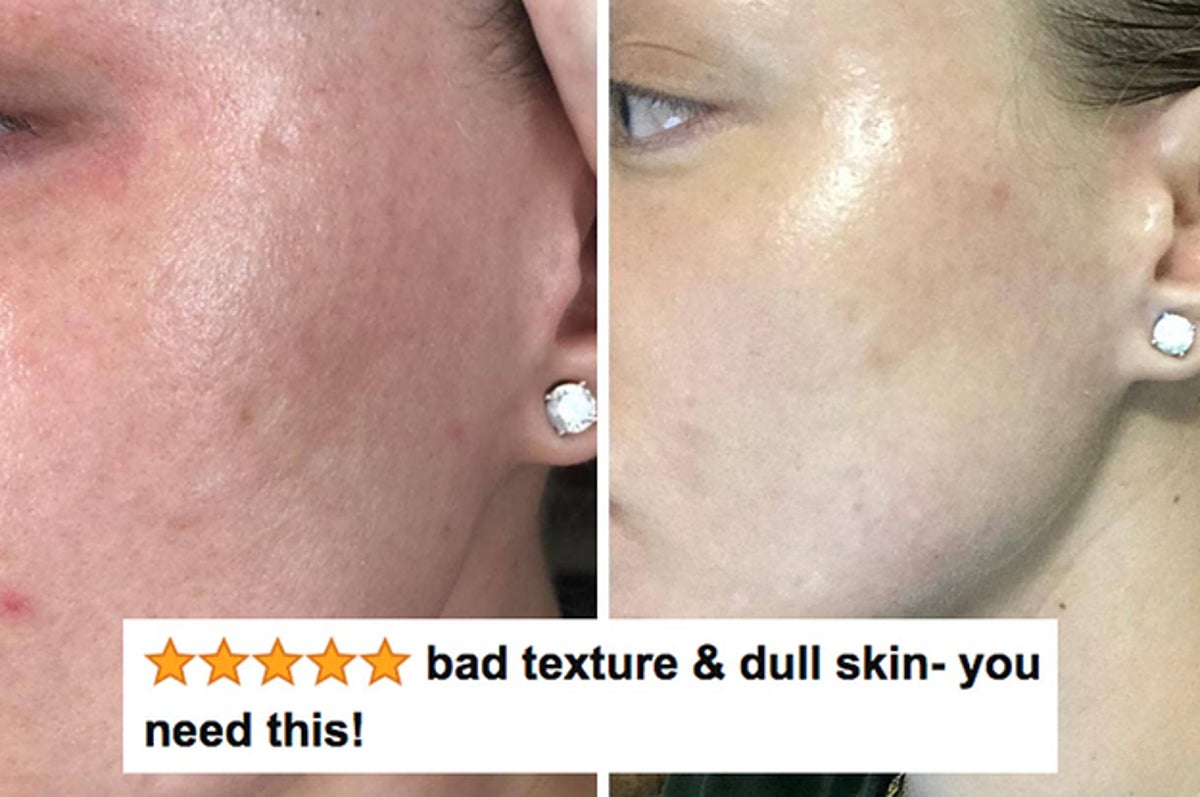 23 Products Designed To Help You Get A More Even Skin Tone