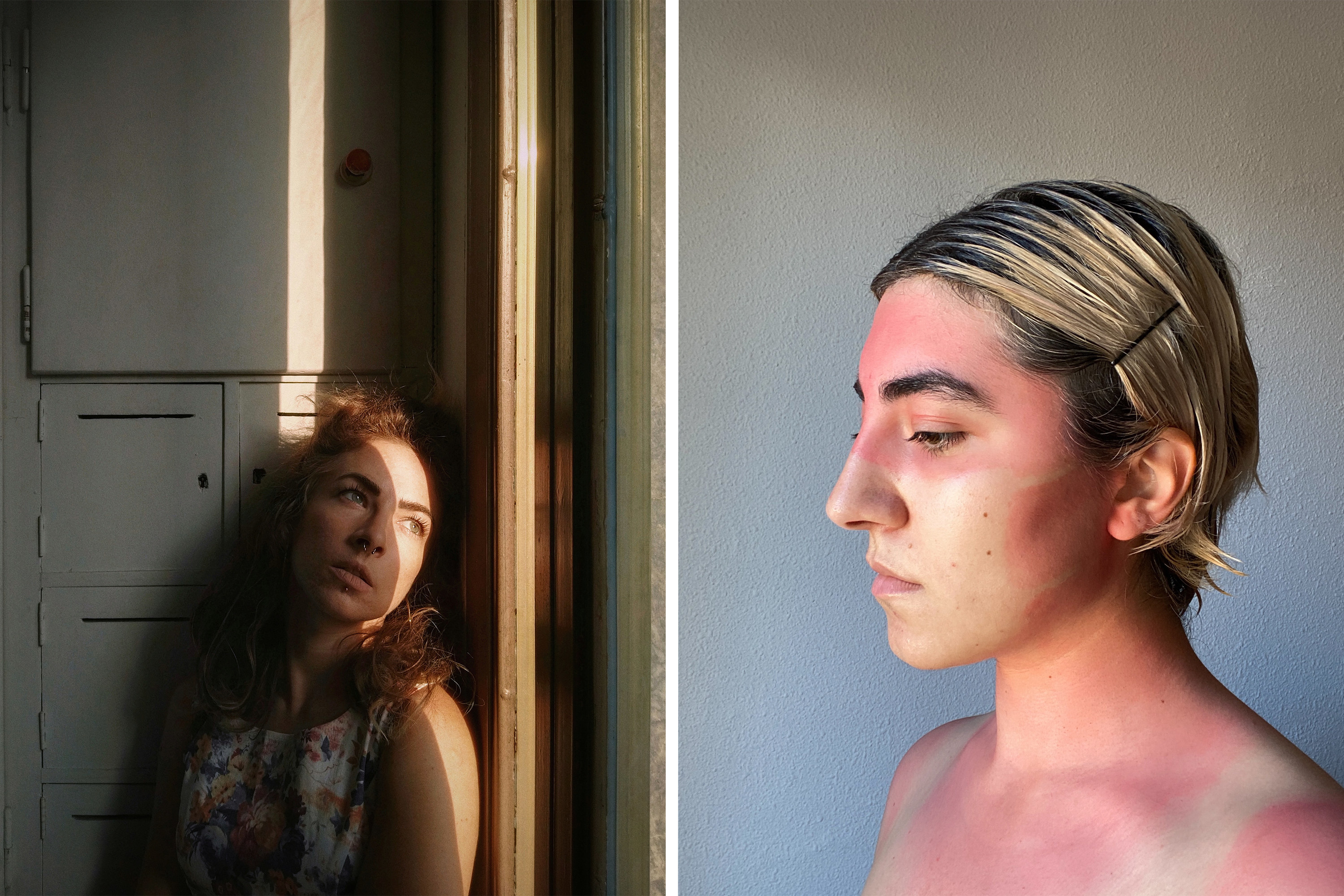 Two side-by-side images show a woman looking out the window with a strip of light on her face, and a girl with a sunburn showing mask lines