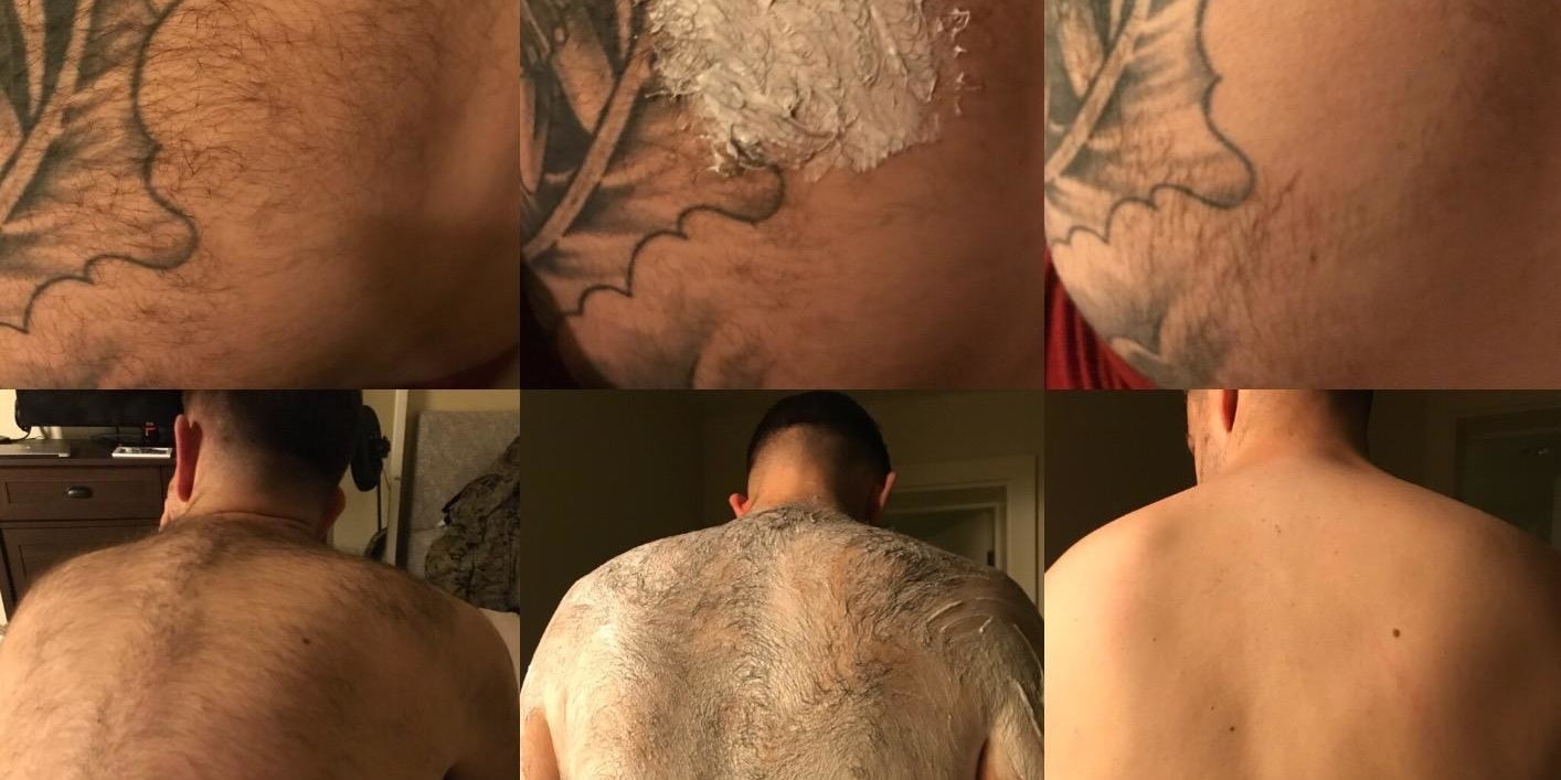 Reviewer before and after images of hair removal gel on back